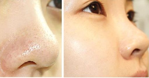 合肥市有哪些值得推薦的美容醫(yī)院？