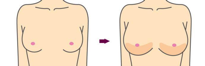 激光祛斑的價(jià)格到底是多少？果對(duì)比圖揭示真相！