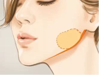 廣州治療祛痘印的專業(yè)醫(yī)院有哪些？