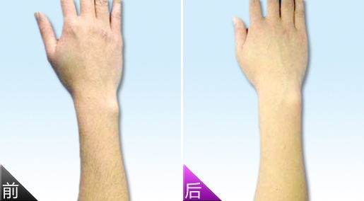 深圳哪家美白美容醫(yī)院效果好？