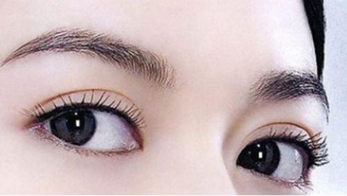 深圳哪家醫(yī)院做隆鼻效果最好？