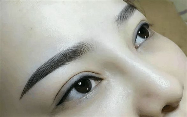 熱瑪吉緊膚除皺適合多大年齡？治療效果是否可靠？