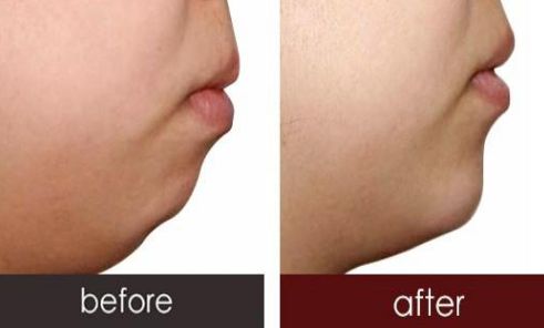 沈陽(yáng)鼻綜合哪家醫(yī)院好？探尋專家推薦出的頂尖醫(yī)療機(jī)構(gòu)