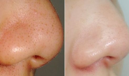 上海磨骨整容醫(yī)院排名及綜合評(píng)價(jià)，哪家好？