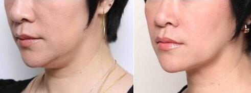 如何快速瘦小腿？低負(fù)荷鍛煉和有氧運(yùn)動(dòng)哪個(gè)更有效？