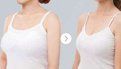 李鐘碩真的承認(rèn)整容了？這個(gè)帥氣的外貌是他后天塑造出來的嗎？