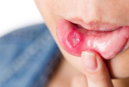 大連哪家醫(yī)院的雙眼皮埋線效果好？