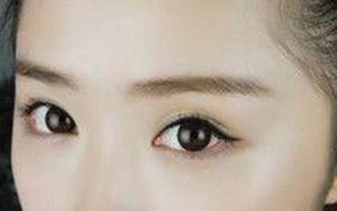 如何進行面部自體脂肪填充？填充面部的項目是否有優(yōu)點和缺點？