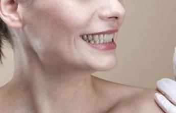 瞿敏吸脂適合哪些人群？可以實現(xiàn)預期效果嗎？