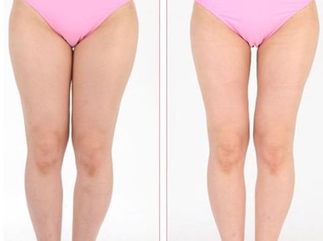 上海激光美容哪家醫(yī)院好？探尋最受用戶喜愛的激光美容機(jī)構(gòu)