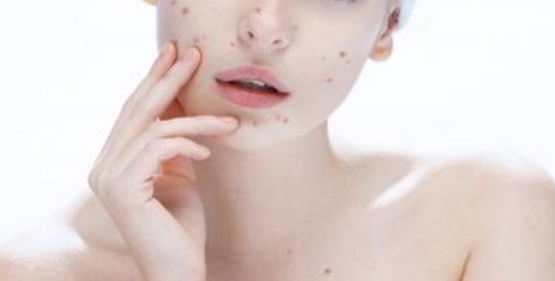 重點(diǎn)推薦：大連眼部整形醫(yī)生，獨(dú)家專長雙眼皮手術(shù)及修復(fù)，受歡迎程度和價格公允！