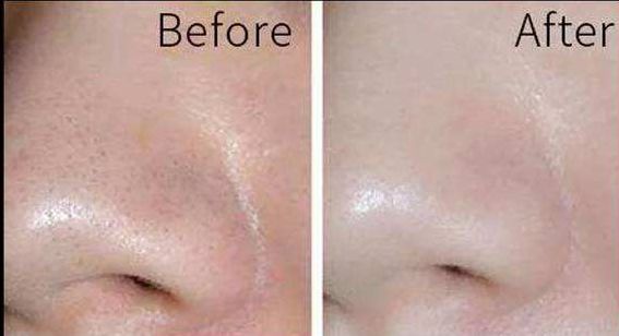 杭州整容醫(yī)院盤點(diǎn)，醫(yī)美大名鼎鼎，值得參考！