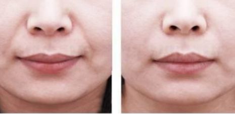 江蘇哪家醫(yī)院是正規(guī)的美容醫(yī)院？靠譜的美容機(jī)構(gòu)排行榜