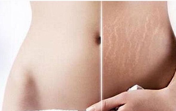 綿陽(yáng)哪家醫(yī)院做眼袋手術(shù)好？