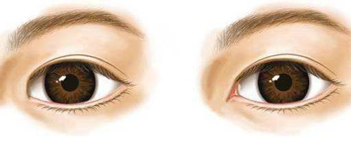 大連哪家醫(yī)院做疤痕手術(shù)效果最好？