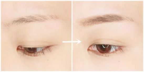 2023年度宜賓比較靠譜的額頭整形美容醫(yī)院排行榜，讓你輕松尋找合適的人造軟骨墊手術(shù)中心