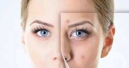 【揭秘】廣州五家熱門胸部整形醫(yī)院，口碑榜前五強(qiáng)_附價(jià)目表全解析！