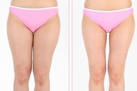 蘇州眼部微整哪家醫(yī)院好？真實(shí)案例揭秘！