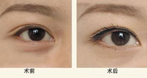 杭州最受用戶推薦的靠譜吸脂醫(yī)院是哪家？