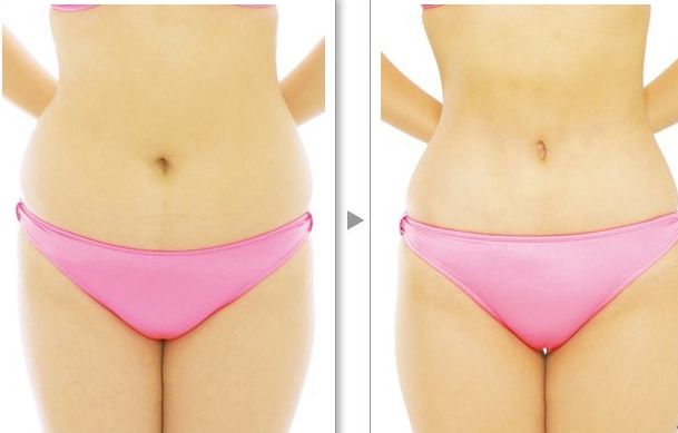 西寧好的隆胸醫(yī)院是哪家好？專家推薦以及詳細解析