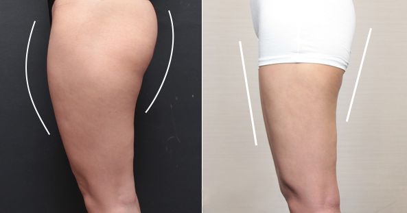 六安哪家醫(yī)院去痣好？告訴你最受歡迎的醫(yī)院！