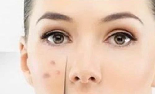 重慶腰部吸脂完美技術(shù)比拼，恭城醫(yī)院對(duì)比整形機(jī)構(gòu)排行！