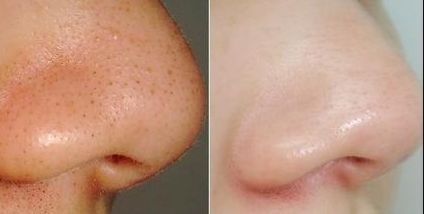 杭州整形美容哪家好？2023杭州整形美容排行榜揭曉