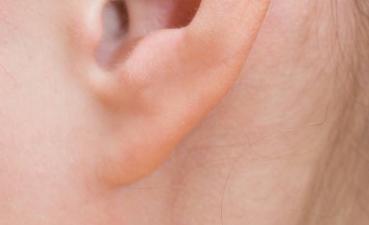 激光洗眉導(dǎo)致疤痕，如何有效去除疤痕？