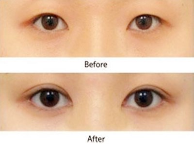 2023年武漢面部微創(chuàng)除皺手術(shù)前10家醫(yī)院排行榜，哪家信譽口碑更好？網(wǎng)友評選推薦！