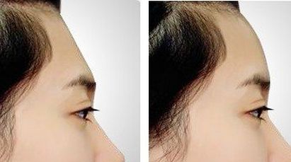 浙江臺州整容醫(yī)院哪家好？如何選擇最適合自己的整容醫(yī)院？