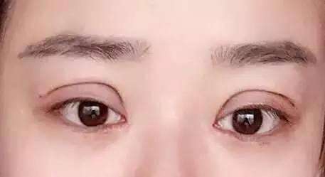 寧波哪家醫(yī)院眼周紋淡化效果好？2023年排行榜前10強值得關(guān)注！