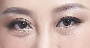 烤瓷牙是什么？它的優(yōu)點(diǎn)在哪里？?jī)r(jià)格大約是多少？