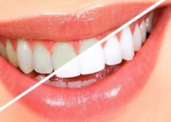 北京哪家醫(yī)院豐面頰好？專家推薦的北京豐面頰頂級(jí)醫(yī)院排行榜！