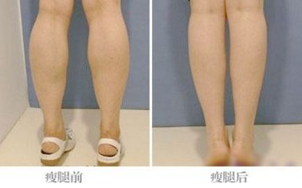 面部拉皮提升專家實力搶眼，哪位醫(yī)生效果比較好？