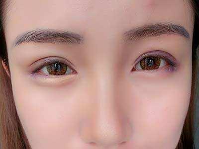 滄州奧拉克醫(yī)療美容醫(yī)院是真的靠譜嗎？醫(yī)生的技術(shù)水平如何？