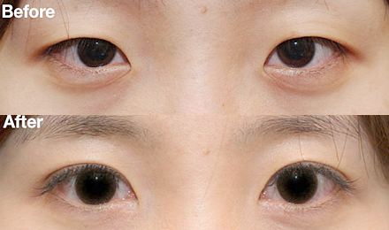 2023年，武漢哪家隆鼻醫(yī)院效果比較好？排名前10家一文推薦