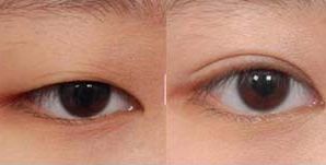 昆明哪家正規(guī)美容醫(yī)院靠譜？-權(quán)威專業(yè)排名引領(lǐng)的推薦！