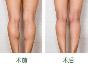 杭州祛眼袋哪家醫(yī)院做的好？