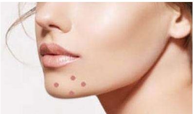 廈門哪家整形醫(yī)院好？2023年附一院、華美、海峽等醫(yī)院盤點！