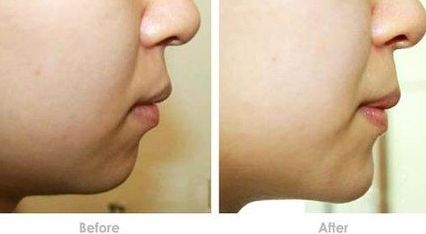 梅州美容整形機構(gòu)盛名傲鎮(zhèn)！2023醫(yī)美榜單大揭曉！