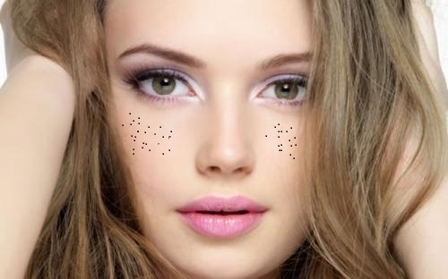 2023年西寧有哪些醫(yī)療整形醫(yī)院能夠有效去除眉間紋？權(quán)威推薦十家！