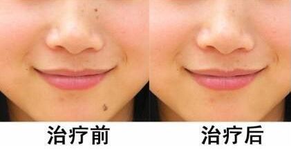 上海私密整形哪家好？專業(yè)推薦來自實際經(jīng)驗的最佳選擇