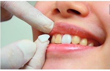 石家莊哪家整形醫(yī)院的雙眼皮割得好？醫(yī)生技術(shù)和審美怎么樣？