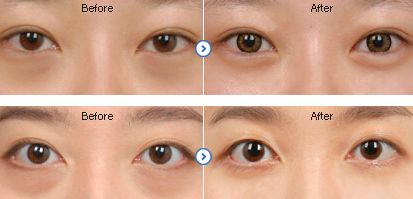 云南玉溪市青春煥發(fā)美容醫(yī)療首選大賞！