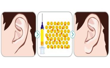 耳垂過大能通過手術(shù)矯正嗎？有沒有縮小耳垂的手術(shù)選擇？