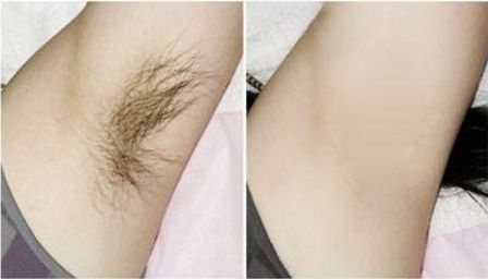 泰安祛黃褐斑哪家醫(yī)院好？選擇正規(guī)醫(yī)院，拒絕黑心機(jī)構(gòu)！