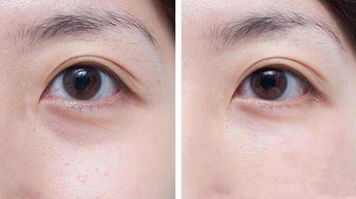 福州射頻除皺醫(yī)院哪家口碑好？