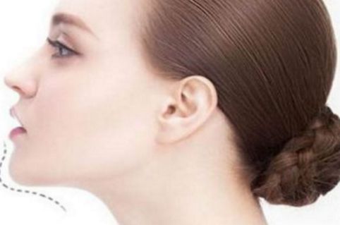 徐州吸脂減肥哪家醫(yī)院好？科學(xué)指導(dǎo)下，找到適合你的徐州吸脂減肥醫(yī)院