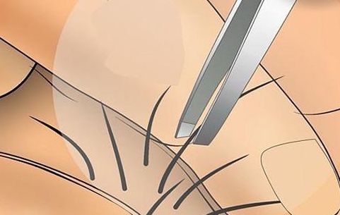 廣東整形哪家整形醫(yī)院好？選對(duì)整容修復(fù)專(zhuān)家，讓您煥然重生