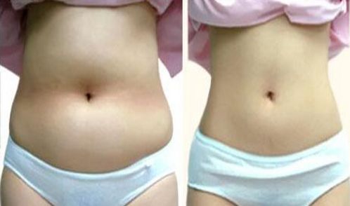 南京祛除雀斑醫(yī)院哪家好？南京專業(yè)祛除雀斑醫(yī)院排行榜分析